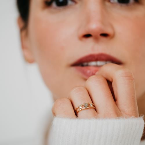 Ring Fabella